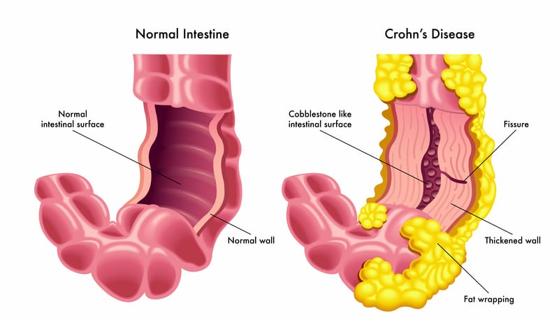 Disease 9